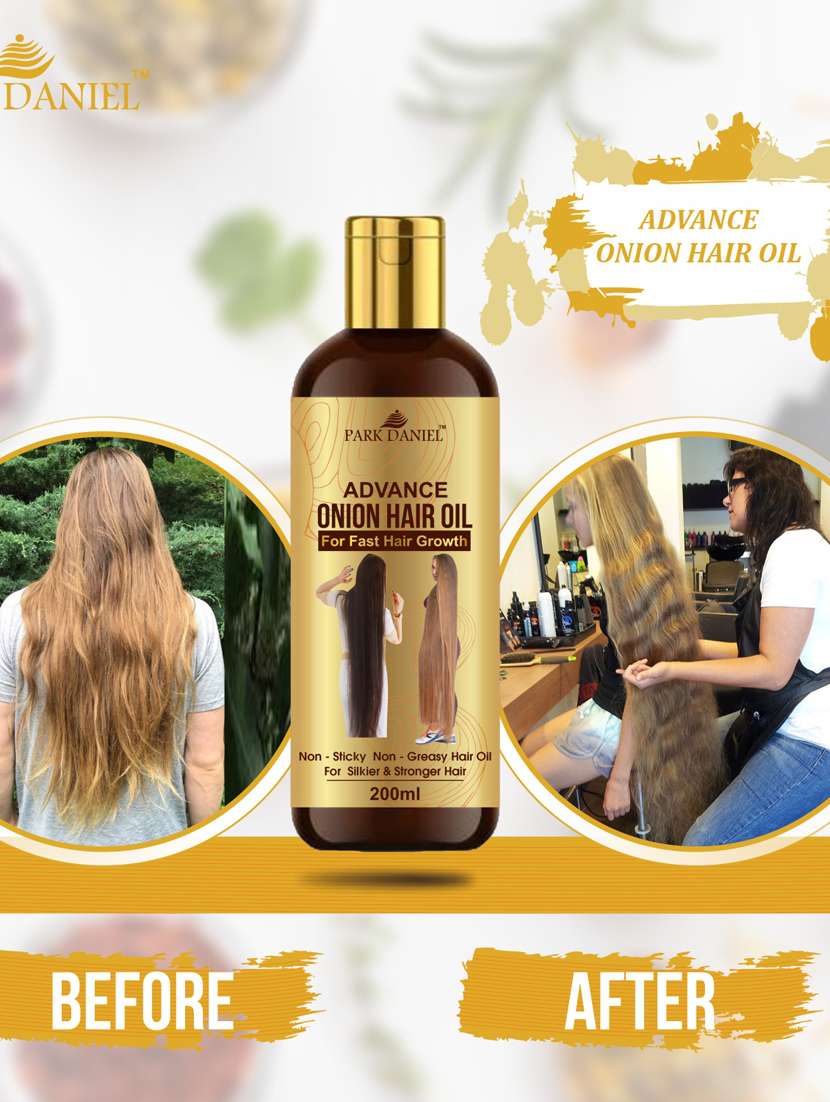 park daniel advanced onion hair oil for reduces hair loss/fall control 200 ml
