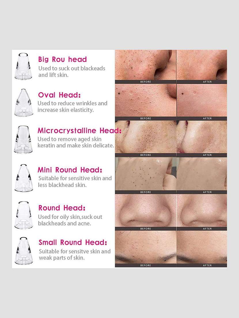 6 in 1 multi-function blackhead remover tools - 22477772 -  Standard Image - 7